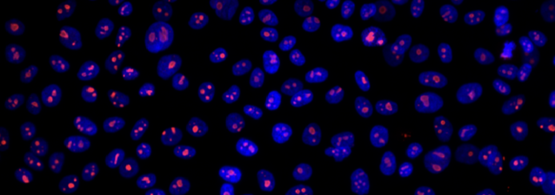 Image of fluorescently tagged cells