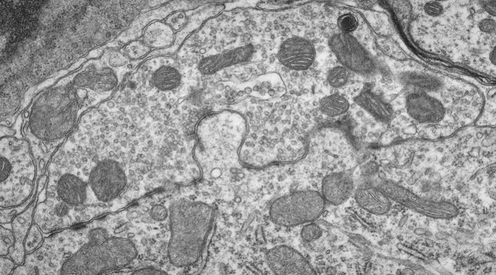 Electron micrograph