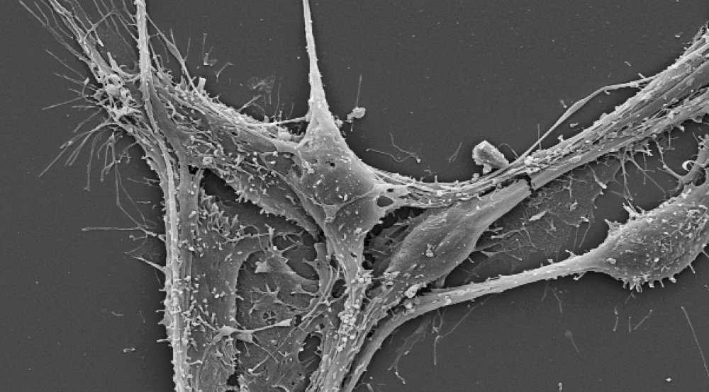 Electron micrograph