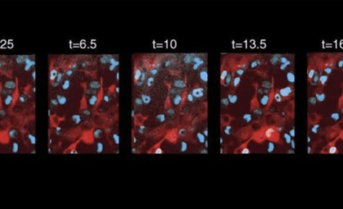 Microscopic image of tissue at various magnifications 