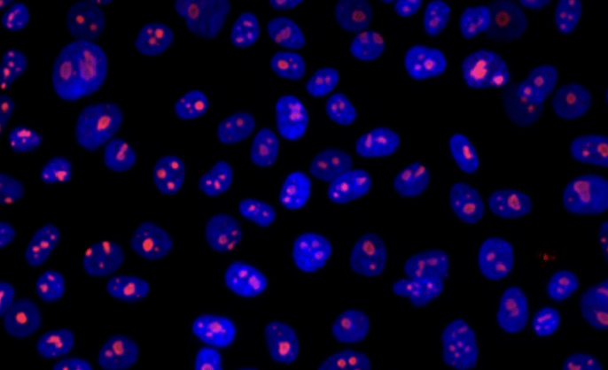 Image of fluorescently tagged cells